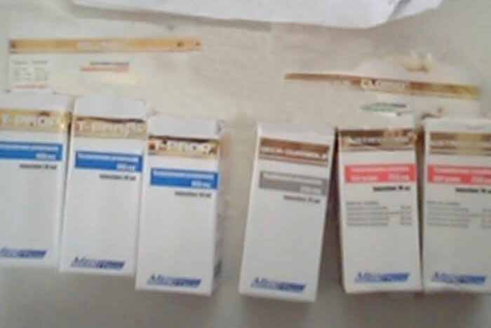 2018년 2월 15일 프랑스 베르사유